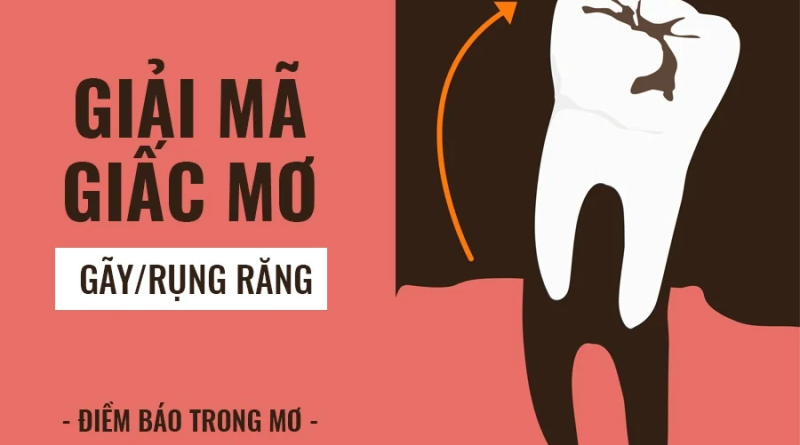 Giấc mơ gãy răng là điềm báo gì? Những con số may mắn liên quan 